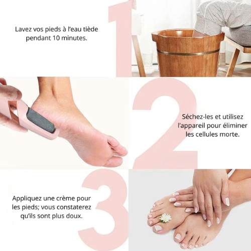 SoftHeel™ – Éliminateur de callosités sans douleur
